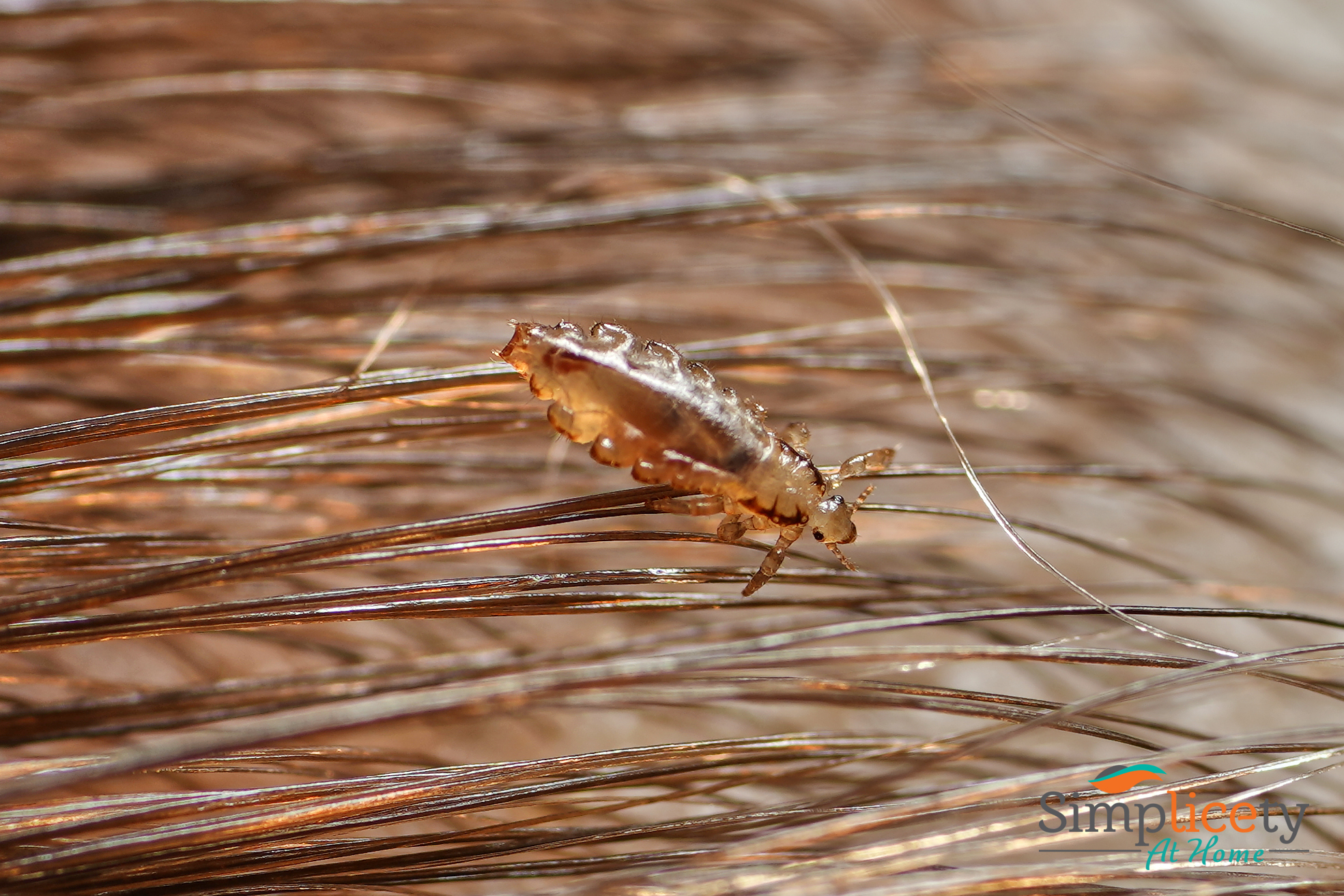 adult head lice - female louse in hair